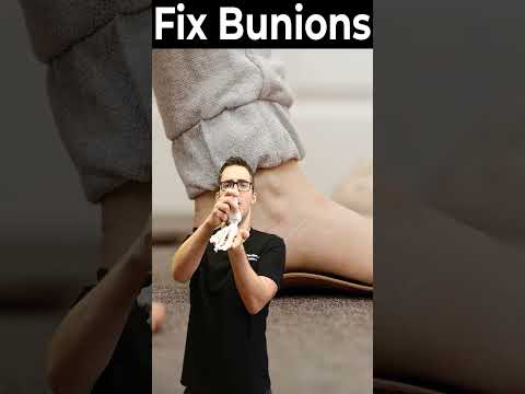 TOP 13 Ways to Shrink Bunions Naturally 1 HUGE SECRET
