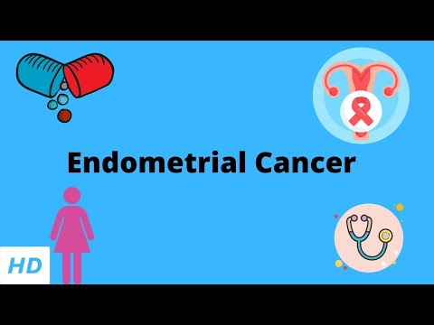 Endometrial Cancer, Causes, Signs and Symptoms, Diagnosis and Treatment.