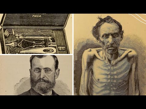 Die Geschichte der Schwindsucht (Tuberkulosebazillus) - Doku Hörspiel