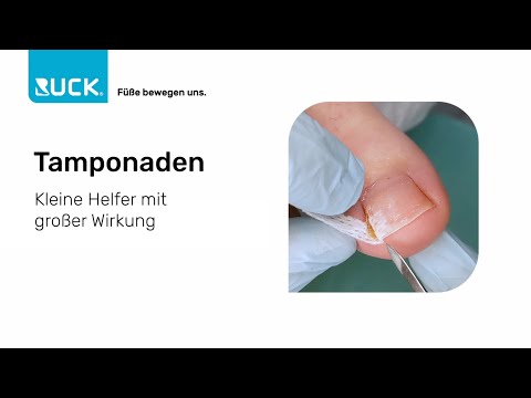 Nagelfalztamponaden Leicht Gemacht - So Geht's!