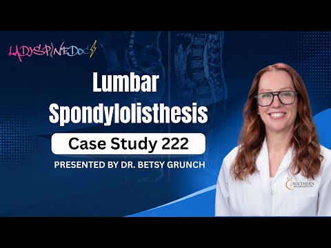 Spondylolisthesis Reddit