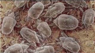 Allergy Symptoms & Treatments : How to Cure Dust Allergies