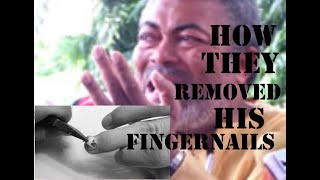 #THROWBACK...Why they plucked out Rawlings' fingernails