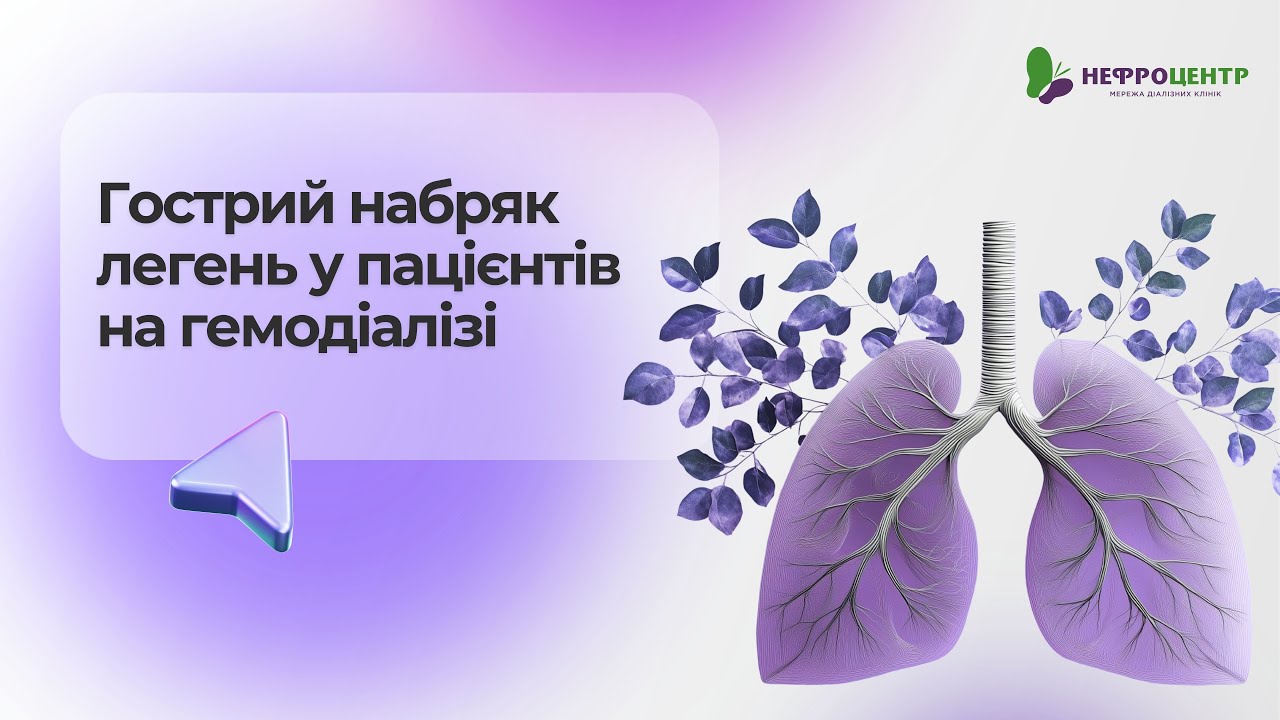 Гострий набряк легень у пацієнтів на гемодіалізі
