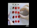 know your blood type