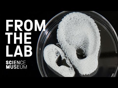 3D printed organ transplants