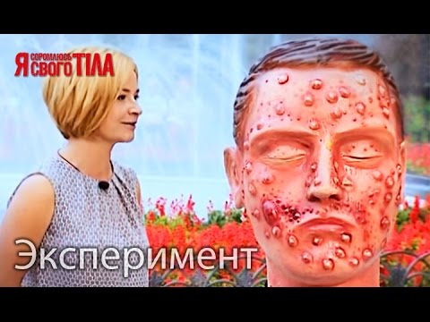 Отбеливающий крем для кожи на интимных местах Пигментные пятна на лице как избавиться перекись