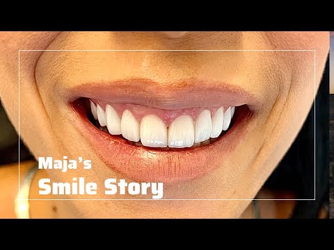 Maja’s Smile Story at Klinik+1 in Istanbul