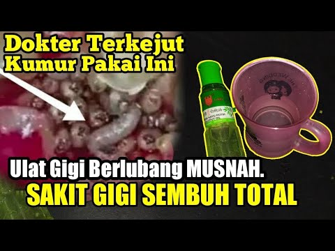 , title : 'Gunakan Ini Sakit Gigi Sembuh. Ulat Gigi keluar semuanya. Recep Obat Herbal'