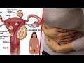HEDHI Sababu 5 Zinazochangia Kukosekana Kwake GLOBAL AFYA