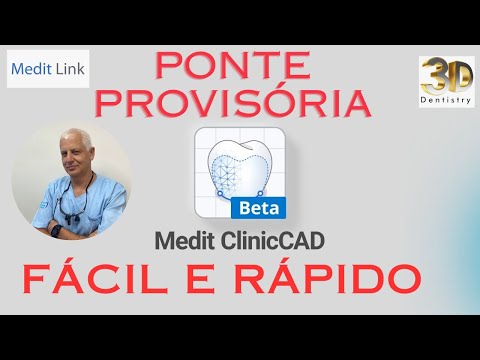 Ponte Provisória- Medit LINK- Medit Cad beta