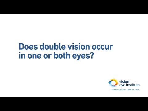 Does double vision occur in one or both eyes?