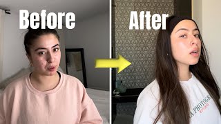 How I transformed my skin! | skin care|