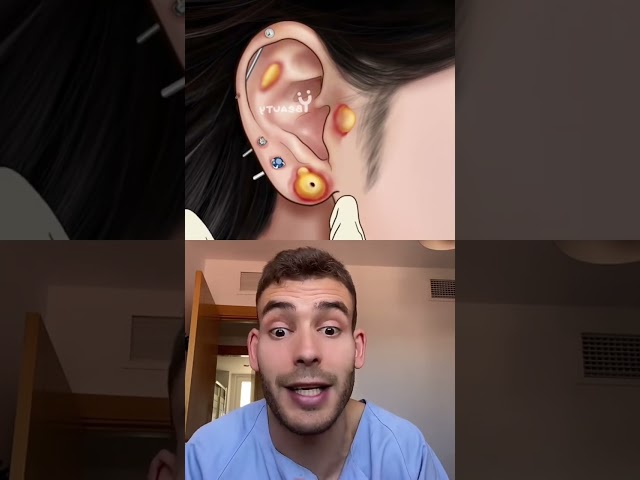 Vídeo relacionado con 5 piezas de acero inoxidable roscado externamente pezón lengua industrial cartílago pendiente barra anillos piercing retenedor 12-22 mm útil y práctico.