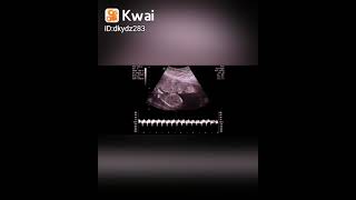 TIMBRES POSTALES AL CIELO (&quot;IN MEMORIAN&quot; MIA YOALI.