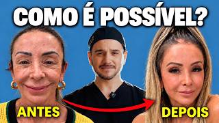 DE 54 PARA 30? Cirurgião analisa brasileira que operou na China