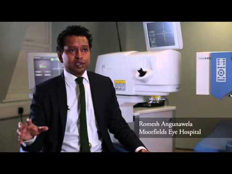 Romesh Angunawela   LASIK vs LASEK