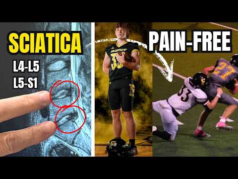 17 Year-Old Heals Sciatica & 2 Disc Herniations (L4-L5, L5-S1)  — Becomes All-Region Linebacker