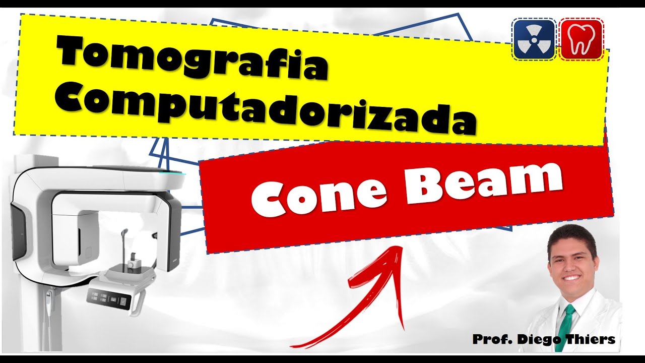 Tomografia cone beam em odontologia