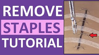 Surgical Staple Removal Nursing | How to Remove Surgical Staples