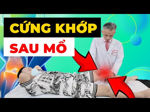 Gối Cứng Đơ Sau Mổ? Đừng Để 1 Tuần Trở Thành Cả Đời Tàn Tật