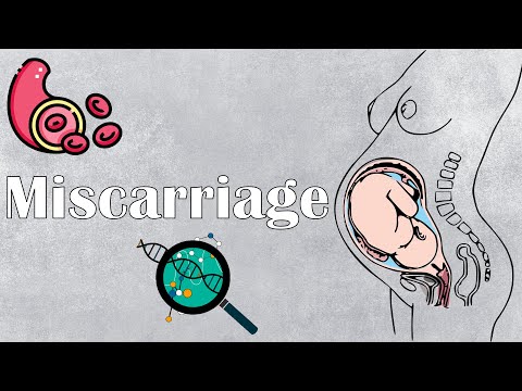 Miscarriage (Spontaneous Abortion) :- Types, Causes & Risk Factors