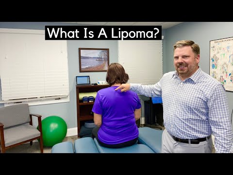 What Is A Lipoma?