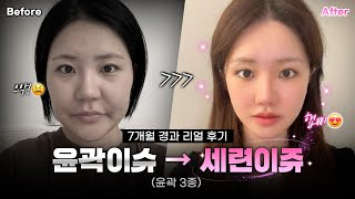 윤곽이슈🧨→  세련이쥬💖 ｜리얼후기