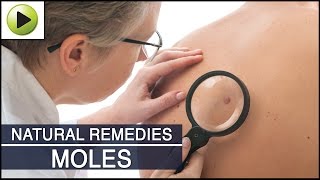 Skin Care - Moles - Natural Ayurvedic Home Remedies
