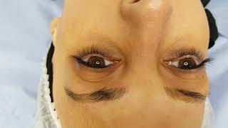Alopecia Eyebrows Realism 3D Microblading by El Truchan @ Perfect Definition