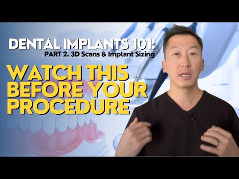 Dental Implants 101: What You NEED to Know! Part 2 (3D Scans & Implant Sizing)