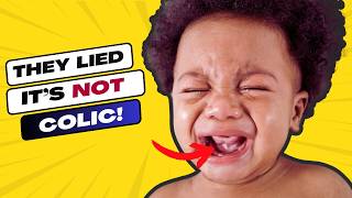 Can Tongue-Tie Really Delay Speech? Here’s What Doctors Won’t Tell You!