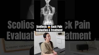 Scoliosis Treatment with Gonstead Chiropractic | Dr. Rahim Case Management #shorts