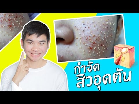 เขาข่มขืนสาวที่มีหน้าอกเล็ก หน้าอกหลังจากพลาสติกที่เกิดขึ้น