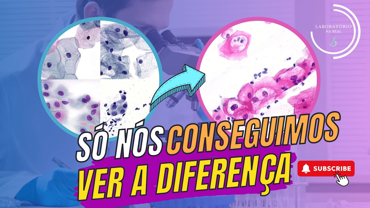 Dicas Práticas para Identificar Lesões Intraepiteliais