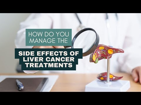 How Do You Manage the Side Effects of Liver Cancer Treatments?