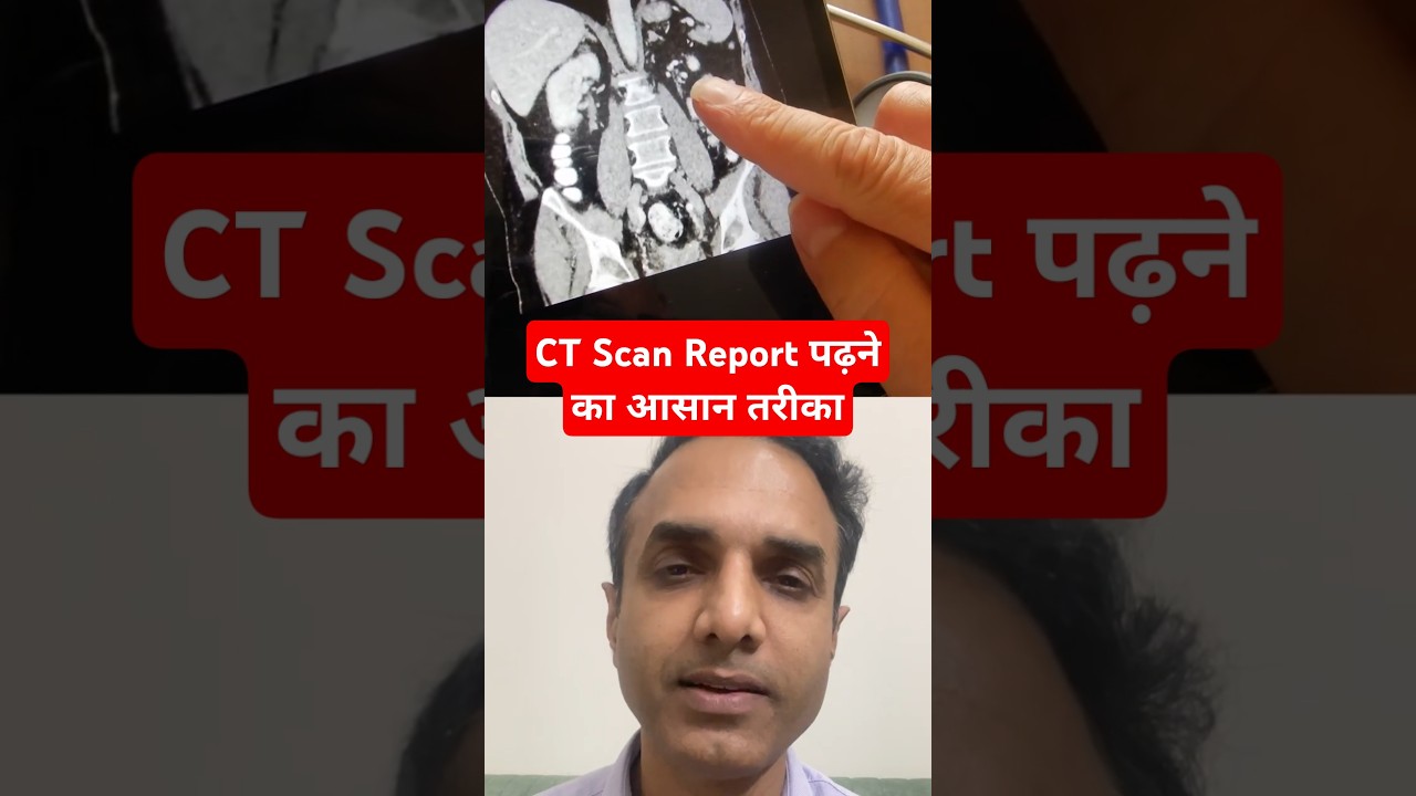 Correct way to read CT scan report #ytshorts #shorts