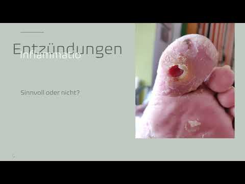 Entzündungen einfach erklärt Teil 1 Was hat sich Mutter Natur dabei gedacht - sinnvoll oder nicht?