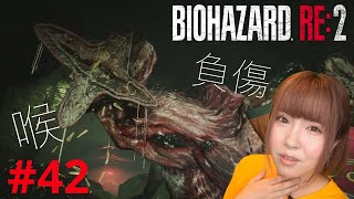 【バイオハザードRE2】プラグを追い求めて下水道の毒吐き野郎に大苦戦！！【実況 #42】