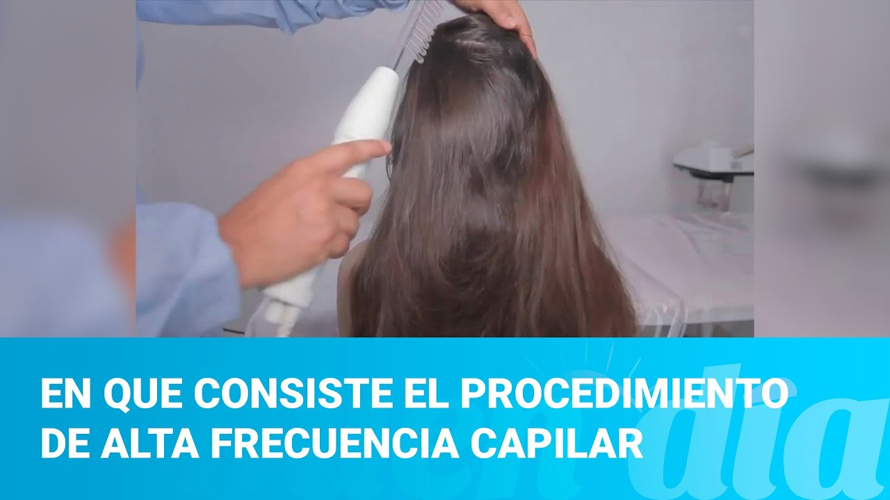 En que consiste el procedimiento de alta frecuencia capilar