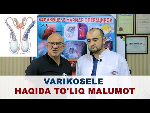 mazi cread cu varicoza inflamaia venelor varicoase
