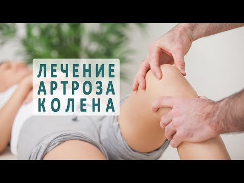 Лечение артроза коленного сустава