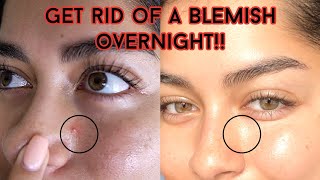 GET RID OF A BLEMISH OVERNIGHT! (for emergencies/special occasions)