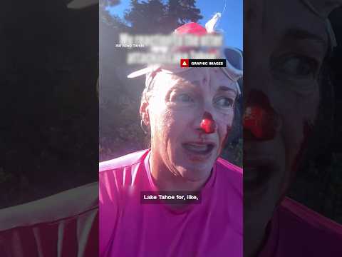 Woman shows bloody aftermath of Lake Tahoe otter attack