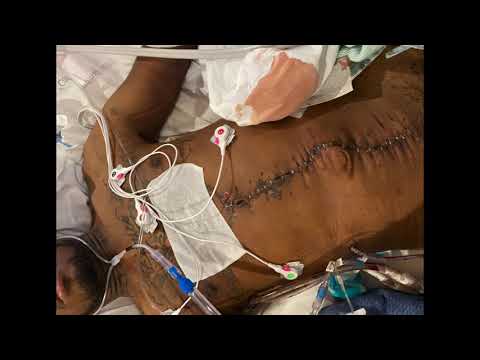 LFD Poodie - Left For Dead [Official video] | shot by @deezymiaci5