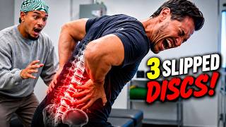 *STIFFEST SPINE* CRACKED WITH *3 HERNIATED DISCS!* 😱 | Chiropractic BACK Pain ASMR Relief | Dr John