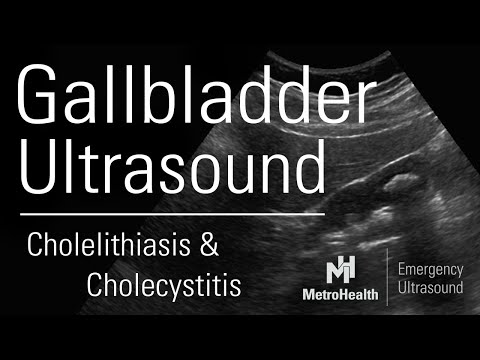 Gallbladder Ultrasound
