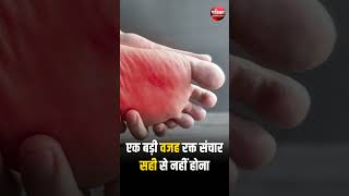 Download lagu जानें, पैरों की ठंडक के कारण-समाधान | Reasons & Solutions Of Cold Feet | Winter Health | Lifestyle mp3 Download lagu जानें, पैरों की ठंडक के कारण-समाधान | Reasons & Solutions Of Cold Feet | Winter Health | Lifestyle mp3