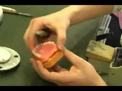 Denture relining - when the denture wobbles