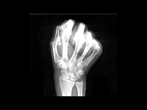 Goregotron - Backstep Fisted (NGHTMR Remix)